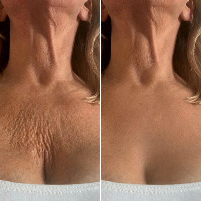 NapBae Anti-Wrinkle Chest Pillow