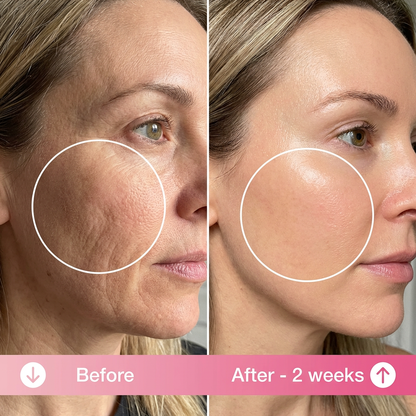 Anti Wrinkle Pillow + Pillowcase.